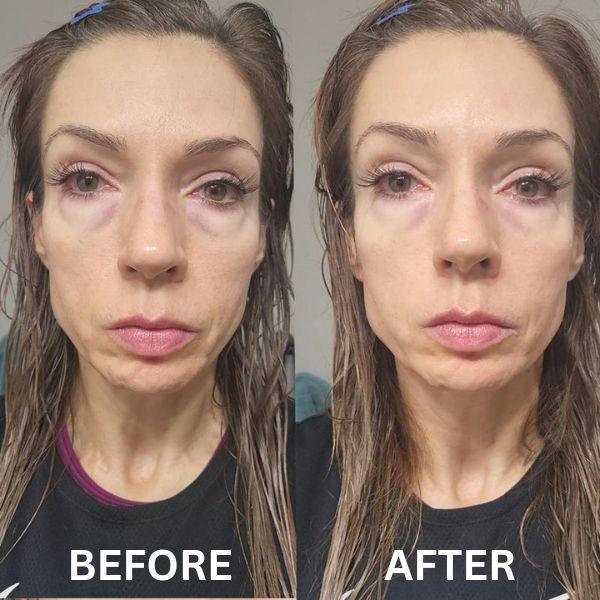 InstantFirm Eye Patches