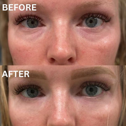 InstantFirm Eye Patches