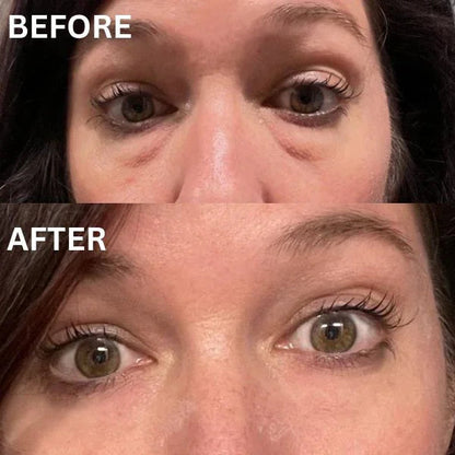 InstantFirm Eye Patches