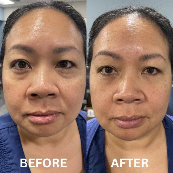 InstantFirm Eye Patches