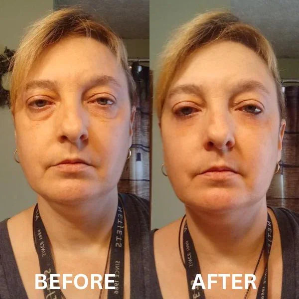 InstantFirm Eye Patches