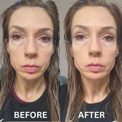 InstantFirm Eye Patches